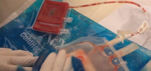 B92 - Zdravlje - Bolesti - Čuvanje matičnih ćelija - zalog za budućnost