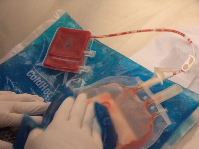 B92 - Zdravlje - Bolesti - Čuvanje matičnih ćelija - zalog za budućnost