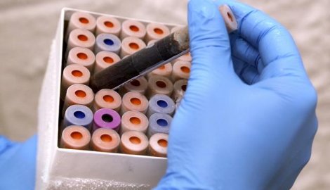 Nađen lek protiv bola