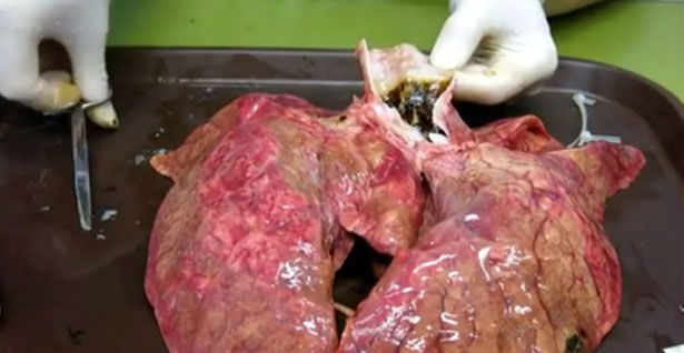 Pušite?! Pogledajte šta samo 60 cigareta uradi vašim plućima