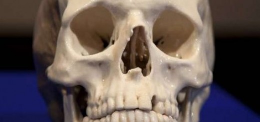 Kosti koje stradaju u tuči značajno su ojačale